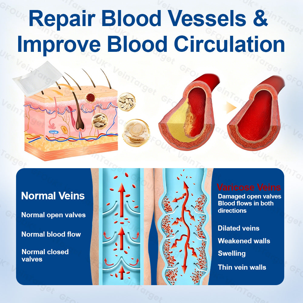 🇨🇦🩹🦵✅GFOUK® EKlinisk Microneedle Patch (with Diosmin & Hesperidin) is an advanced plant-based formulation specially developed to target spider veins and varicose veins, while also helping to relieve the feeling of heavy and tired legs.-K2